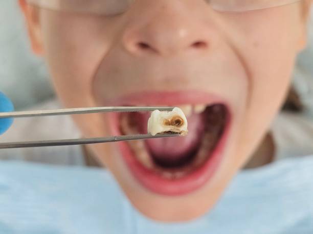 Best Pediatric Emergency Dentist in New Cassel, NY